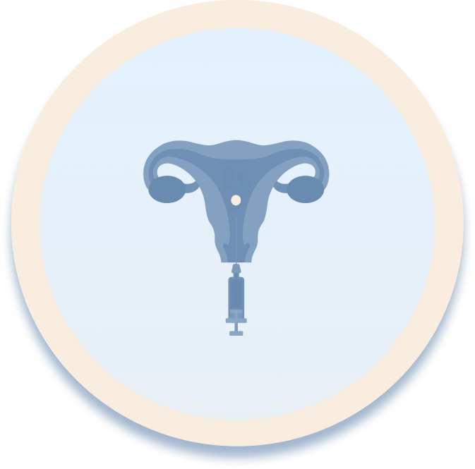 Embryo transfer